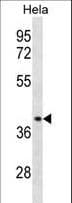 ACKR2 / CCR10 / D6 Antibody (aa298-328)