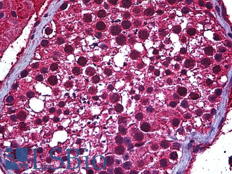 IHC-plus™ Monoclonal Mouse anti-Human SP140 Antibody (clone 3F9, IHC)