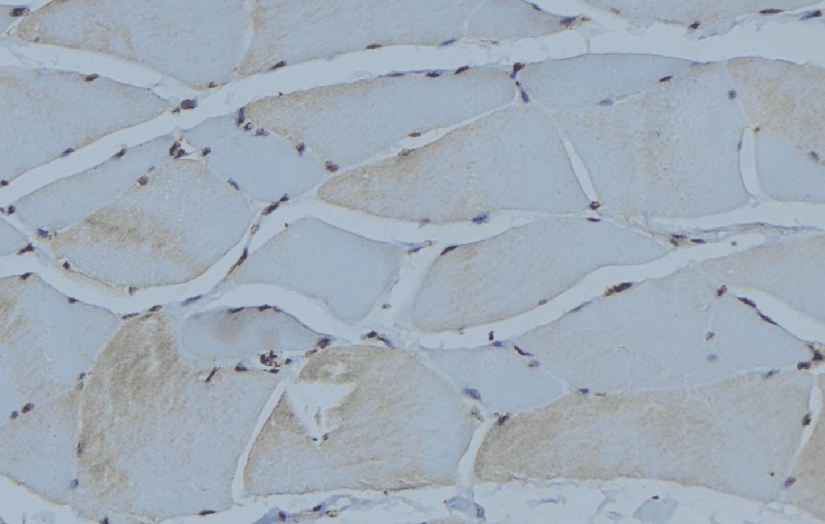 ACTN2 Antibody