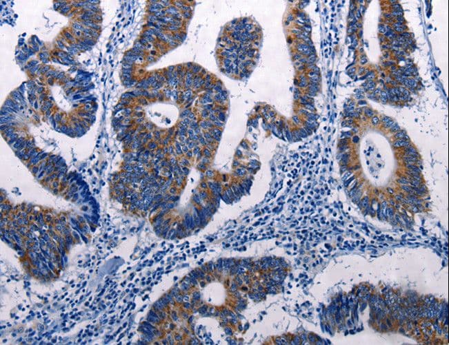 Polyclonal Rabbit anti-Human DUSP6 / MKP3 Antibody (IHC)