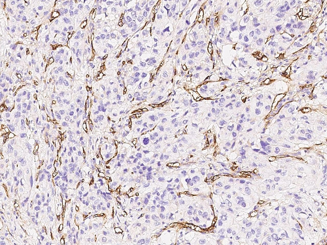 CD105 Antibody (Preservative Free)