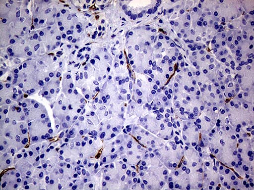 Monoclonal Mouse anti-Human NES / Nestin Antibody (clone OTI1B4, aa99-349, IHC, WB)
