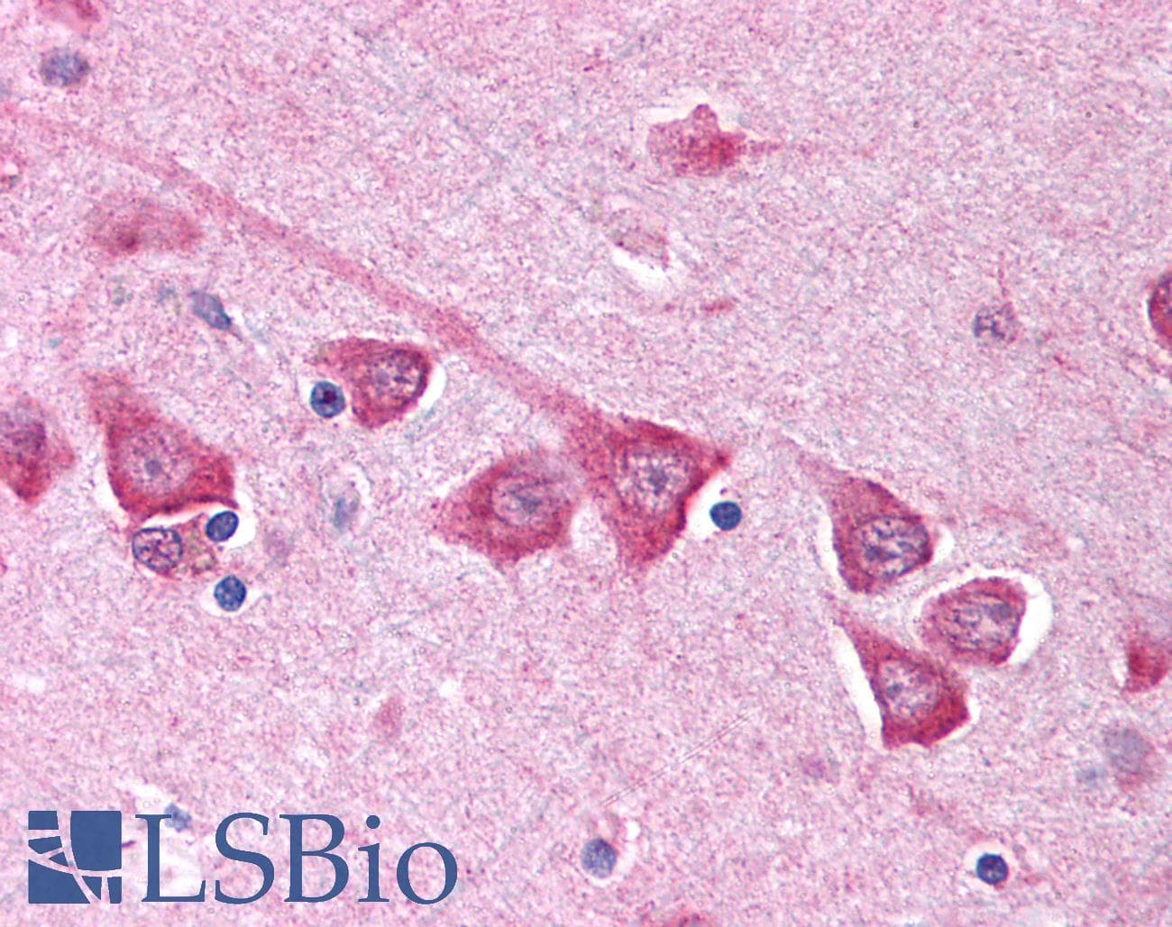 SCN3B Antibody (aa65-114)