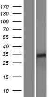 RHBDL2 / RRP2 Protein (Over-Expression Lysate Myc-DDK (Flag))