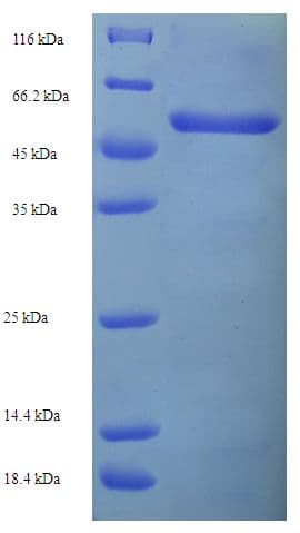 Human KCNAB2 / Kv-Beta-2 Protein (Recombinant His-SUMO)