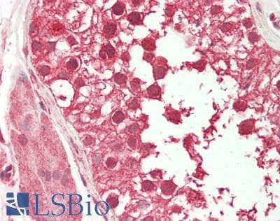 IHC-plus™ VAMP7 / SYBL1 / T1 VAMP Antibody (aa105-155)