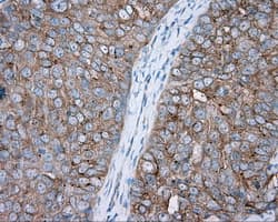 PRKAR2A Antibody (clone OTI1A7, Carrier-free)
