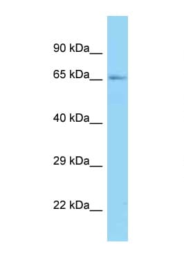 RNGTT / HCAP Antibody (aa66-115)