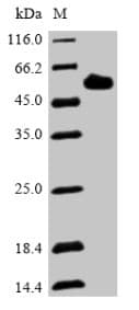 Human DMP1 Protein (Recombinant 6His, N-terminus)