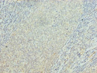 OSBPL2 Antibody