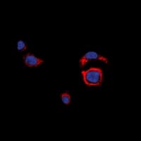 Polyclonal Rabbit anti-Human DNAM-1 / CD226 Antibody (C-Terminus, IHC, IF, WB)