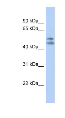 PAFAH1B1 / LIS1 Antibody (N-Terminus)