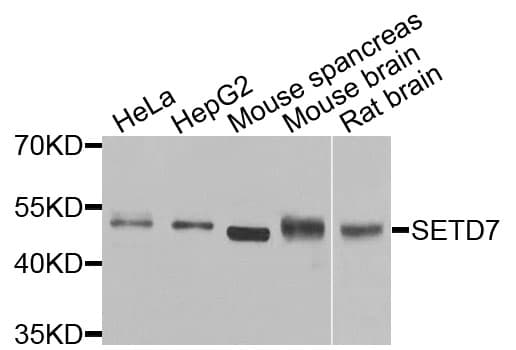 SETD7 / SET7 Antibody
