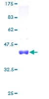Human LSM3 Protein (Recombinant GST)