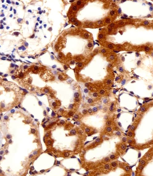 FBXL17 Antibody (aa262-297)
