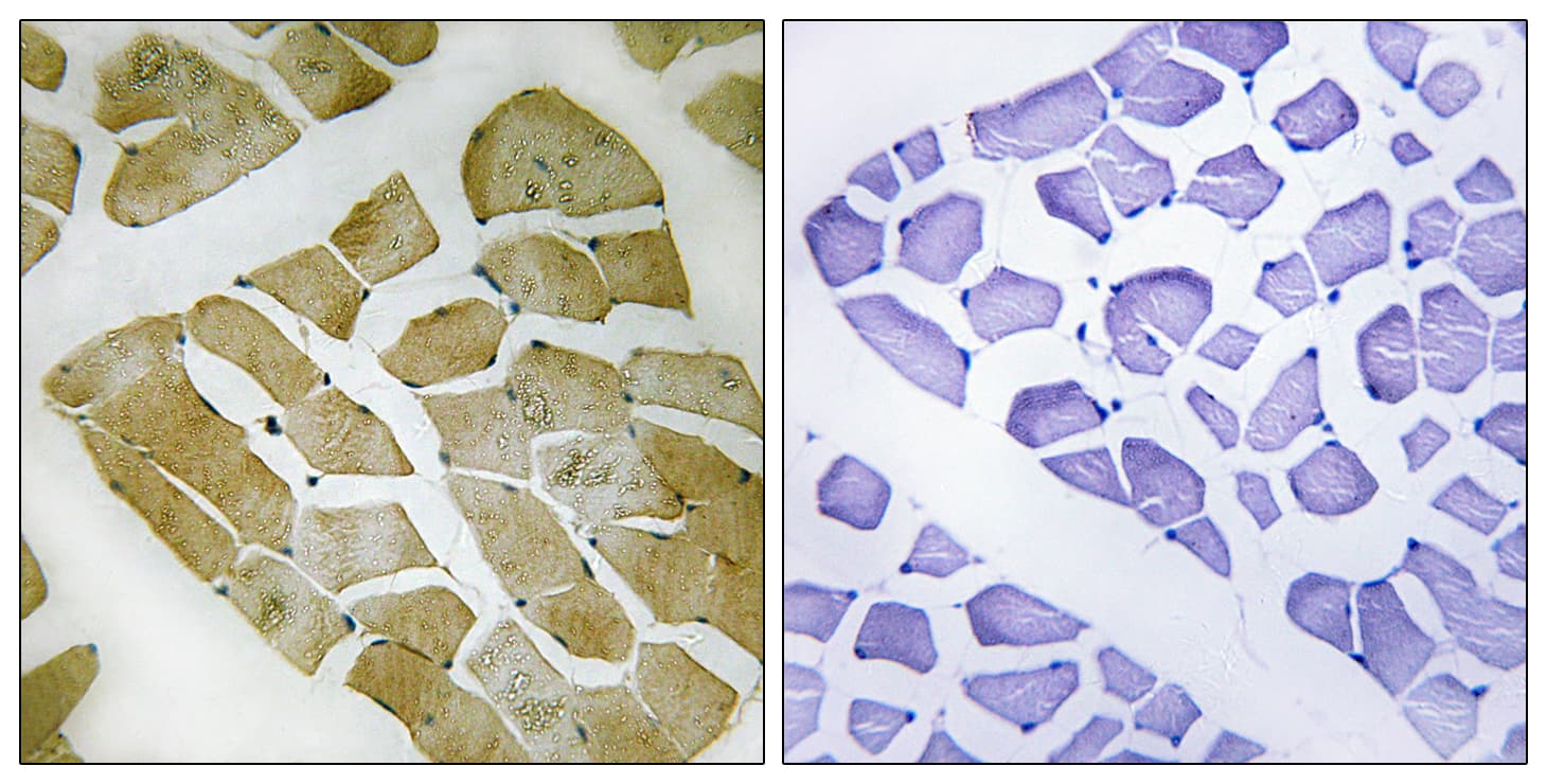 Polyclonal Rabbit anti-Human MYH4 Antibody (aa1677-1726, IHC)