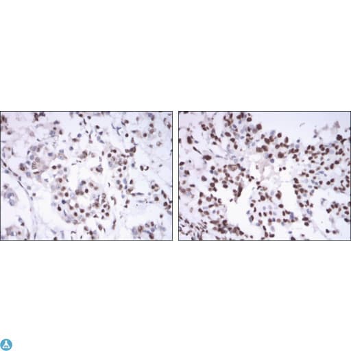 ER Alpha / Estrogen Receptor Antibody
