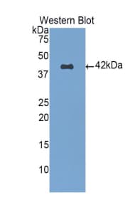 PathPlus™ Tryptase Antibody (aa161-262)