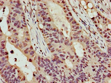 HIST1H4I Antibody