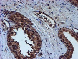 PSMB9 Antibody (aa21-219, clone OTI2G6)