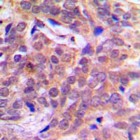 Polyclonal Rabbit anti-Human CTNNB1 / Beta Catenin Antibody (phospho-Ser37, IHC, IF, WB)