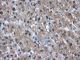 Monoclonal Mouse anti-Human DCXR Antibody (clone OTI7D11, IHC, WB)