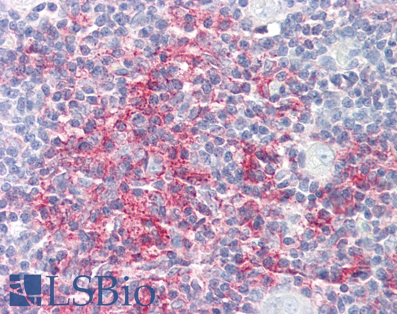 IHC-plus™ Polyclonal Rabbit anti-Human NDUFS5 Antibody (aa57-106, IHC)