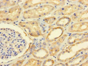 Polyclonal Rabbit anti-Human FAM71A Antibody