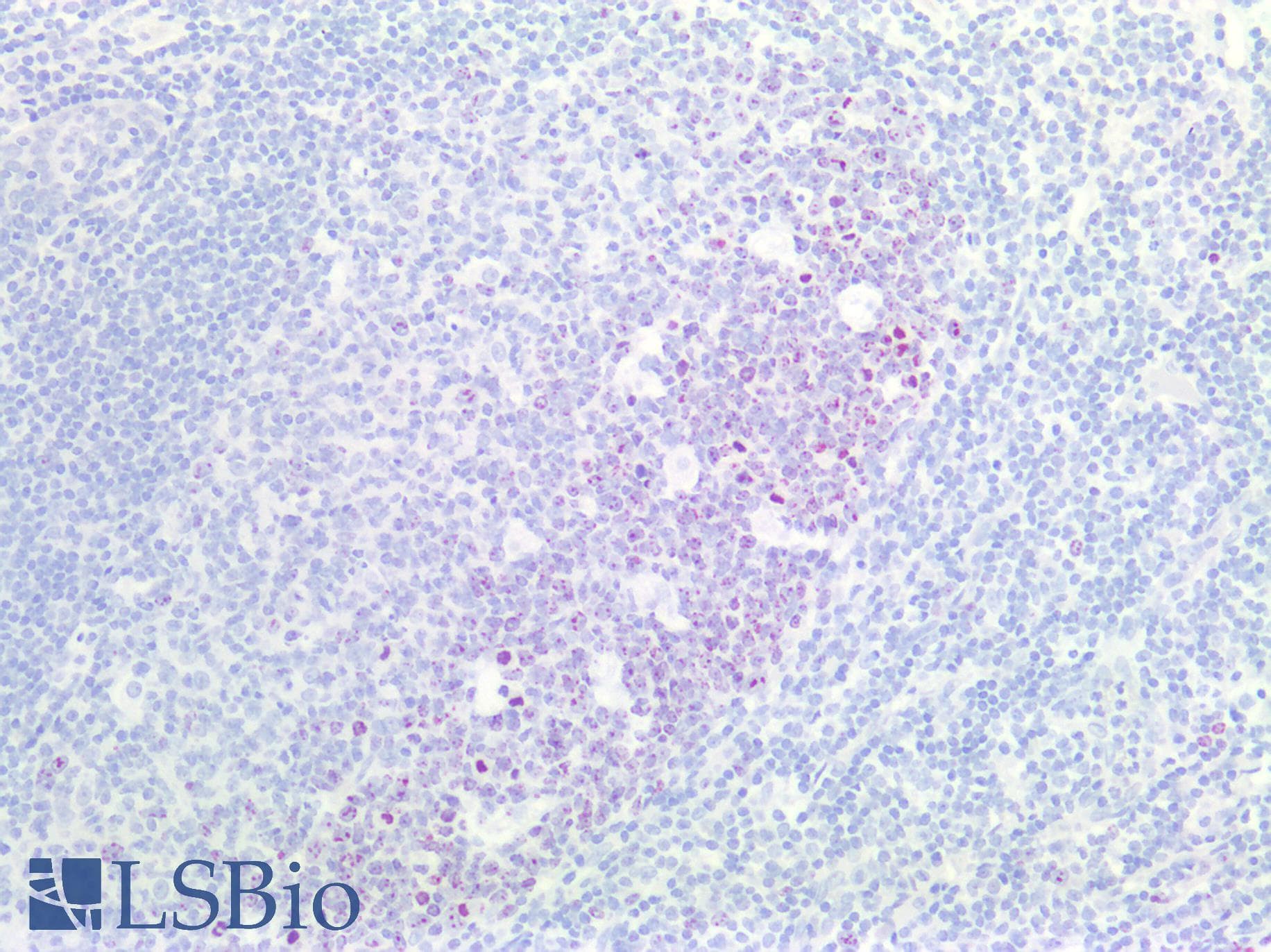 IHC-plus™ MKI67 / Ki67 Antibody