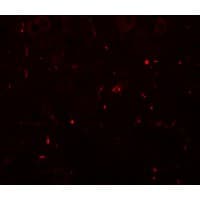 IHC-plus™ SEC62 / TP-1 Antibody