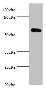 Polyclonal Rabbit anti-Human KLF4 Antibody (aa30-230, IHC, WB)