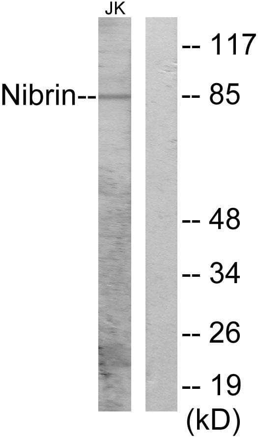NBN / Nibrin Antibody (p278)