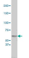 Monoclonal Mouse anti-Human Tyrosinase Antibody (clone 2A2-F4, WB)