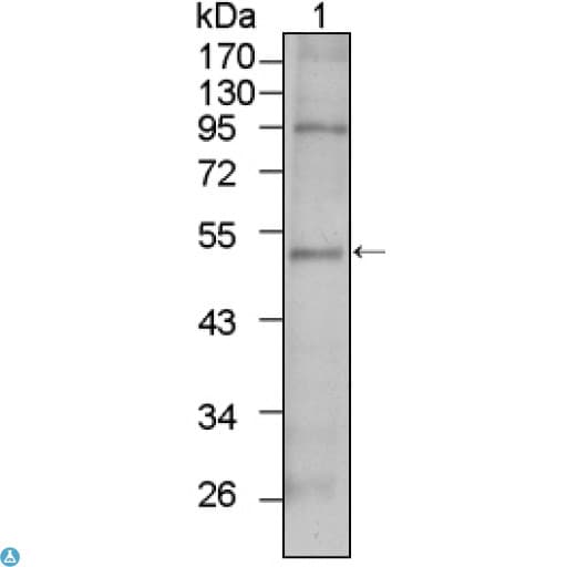 TBX5 Antibody
