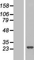 RPE Protein (Over-Expression Lysate Myc-DDK (Flag))