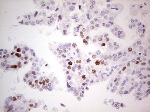 Monoclonal Mouse anti-Human TP53 / p53 Antibody (clone OTI7F3, IHC, WB)