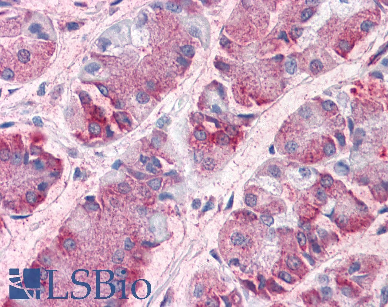 IHC-plus™ GCNT3 Antibody (Internal)