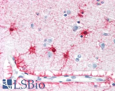 IHC-plus™ VPS45 Antibody (aa558-570)
