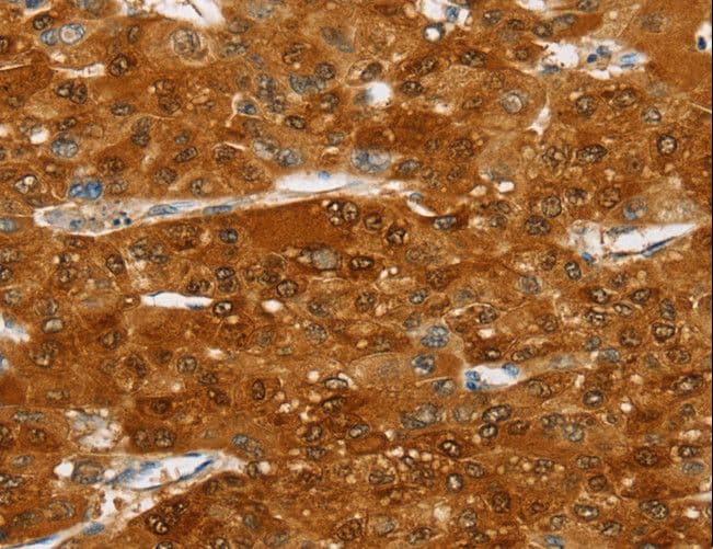 SULT2A1 / Sulfotransferase 2A1 Antibody