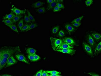IHC-plus™ Polyclonal Rabbit anti-Human CYB5A / Cytochrome b5 Antibody (IHC, WB)
