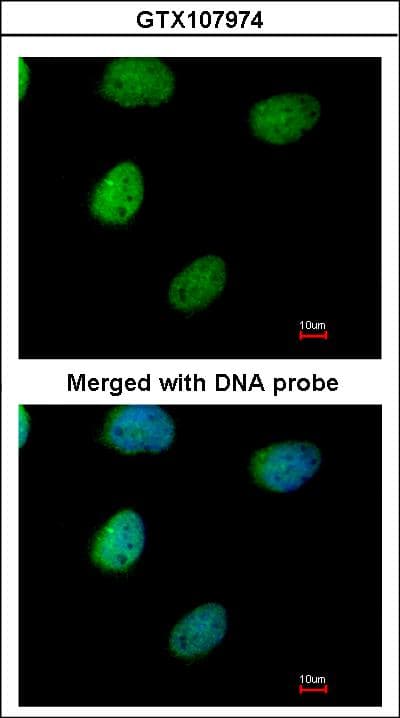 Polyclonal Rabbit anti-Human ITPK1 Antibody (aa171-414, WB)
