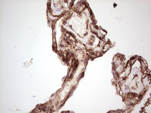 LGALS9 / Galectin 9 Antibody (clone OTI1D12)