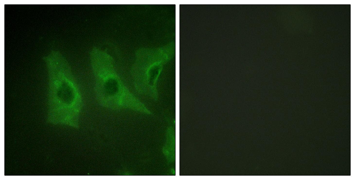 CSNK1A1 / CK1 Alpha Antibody (p321)