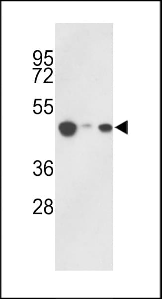 IHC-plus™ Polyclonal Rabbit anti-Human HAT1 Antibody (aa389-419, IHC, WB)