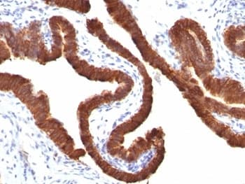 KRT19 / CK19 / Cytokeratin 19 Antibody (clone KRT19/799)