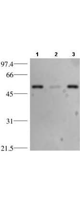 IHC-plus™ TP53 / p53 Antibody (clone BP53-12)