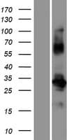POM121L12 Protein (Over-Expression Lysate Myc-DDK (Flag))