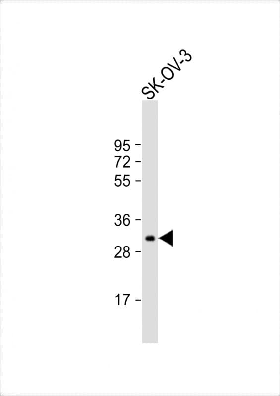 IGFBP5 Antibody (aa87-121)