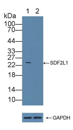 Polyclonal Rabbit anti-Human COL3A1 / Collagen III Antibody (aa1059-1466, WB)