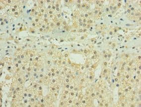 Polyclonal Rabbit anti-Human HYLS1 Antibody (aa70-299, IHC, WB)